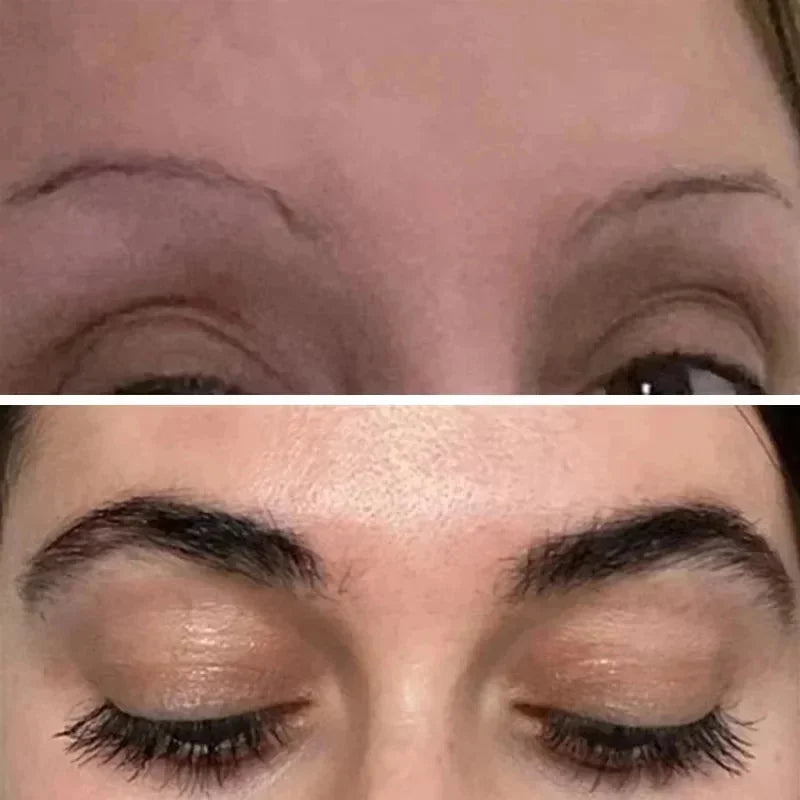 LASHGROW™ |Fast Eyebrow/Lash Growth Serum, Anti Hairs Loss Product, Letting You Have a Fuller and Thicker Eyebrows and Lashes, Lengthening Serum