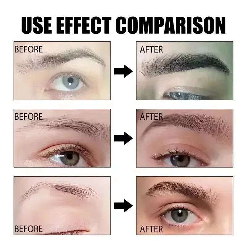 LASHGROW™ |Fast Eyebrow/Lash Growth Serum, Anti Hairs Loss Product, Letting You Have a Fuller and Thicker Eyebrows and Lashes, Lengthening Serum