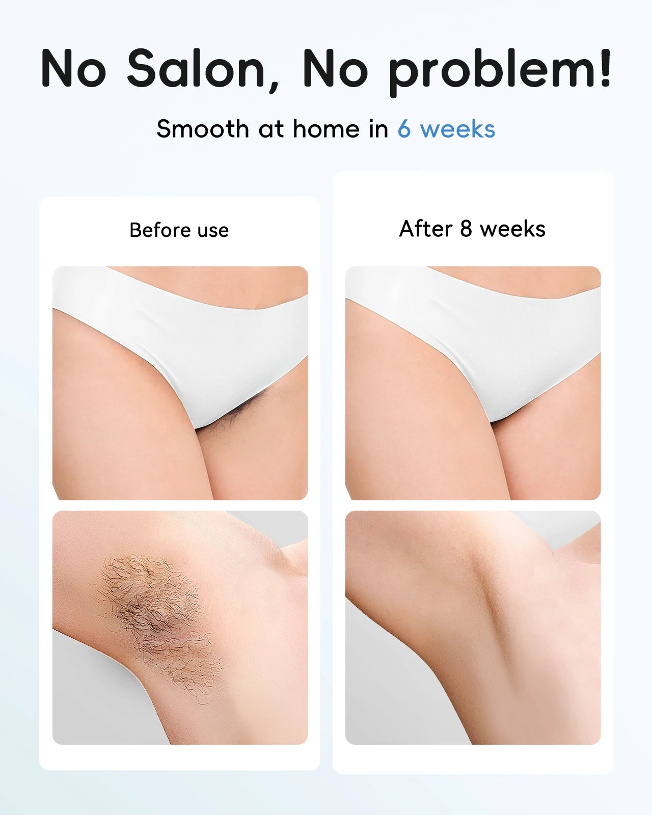 TOTMIZBY ™️Laser Hair Removal Epilator Painless for Women and MEN IPL Hair Removal Home Hair Removal Beauty Device Facial Body Bikini Permanent