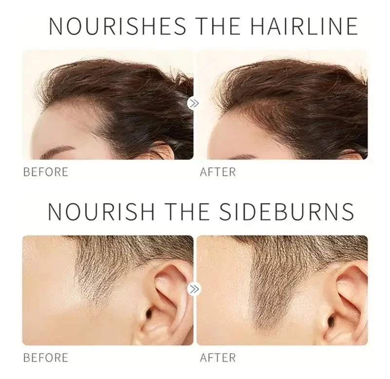 LASHGROW™ |Fast Eyebrow/Lash Growth Serum, Anti Hairs Loss Product, Letting You Have a Fuller and Thicker Eyebrows and Lashes, Lengthening Serum