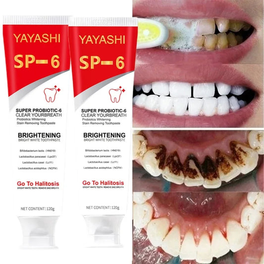 Sweet Tooth Whitener™ Probiotic Toothpaste SP-6 Whitening Tooth Remove Plaque Stains Teeth Whitener Oral Hygiene Clean Fresh Breath Denta 120g New