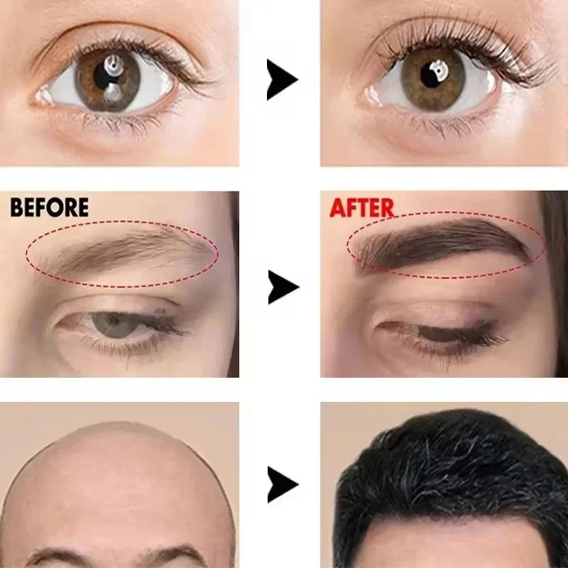 LASHGROW™ |Fast Eyebrow/Lash Growth Serum, Anti Hairs Loss Product, Letting You Have a Fuller and Thicker Eyebrows and Lashes, Lengthening Serum