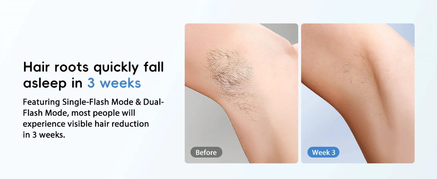 TOTMIZBY ™️Laser Hair Removal Epilator Painless for Women and MEN IPL Hair Removal Home Hair Removal Beauty Device Facial Body Bikini Permanent