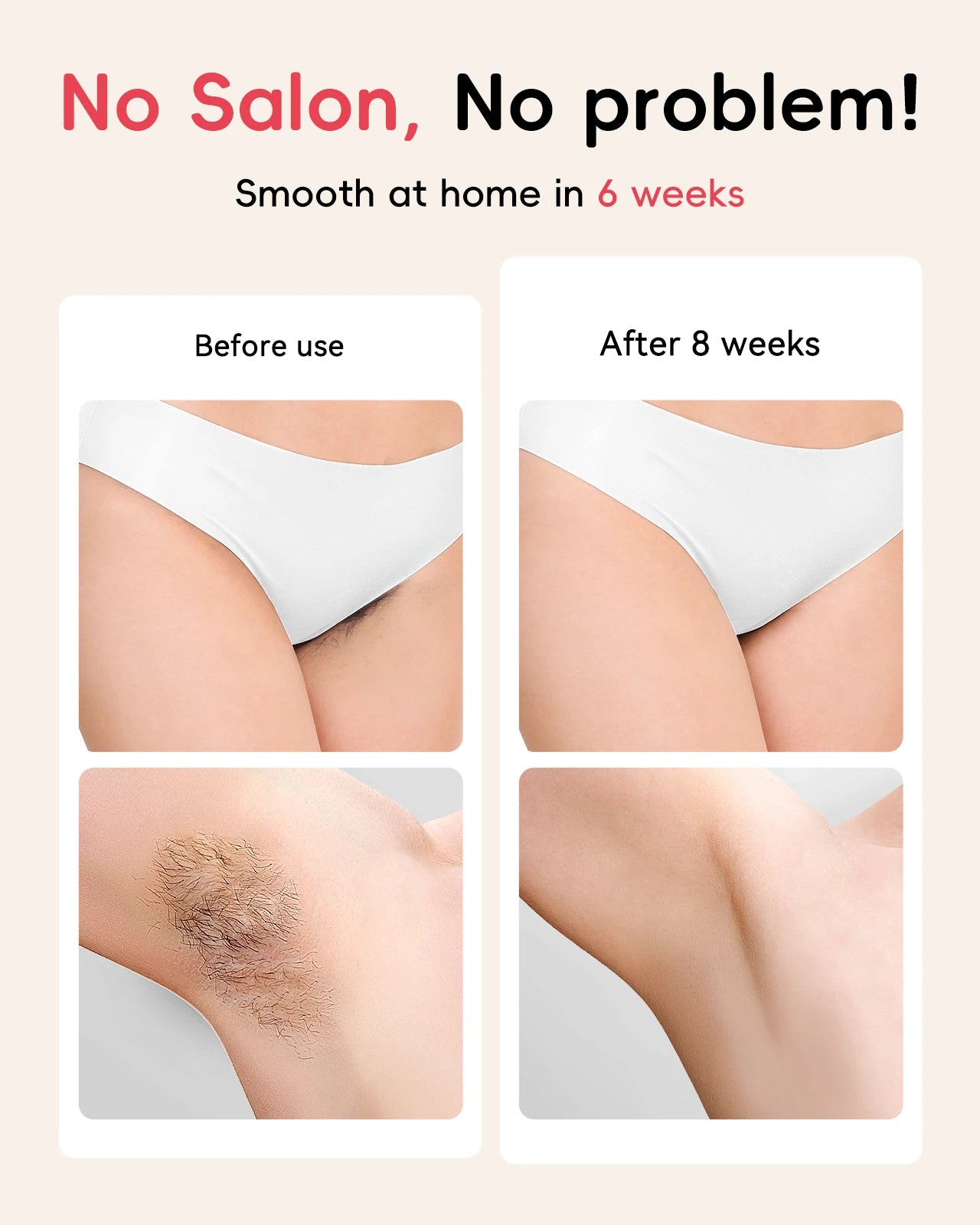 JOOYEE™️Hair Removal Laser IPL 22 Unlimited IGBT 5.2 cm² light Quick Flashes Painless Epilator Face Armpit Bikini Laser