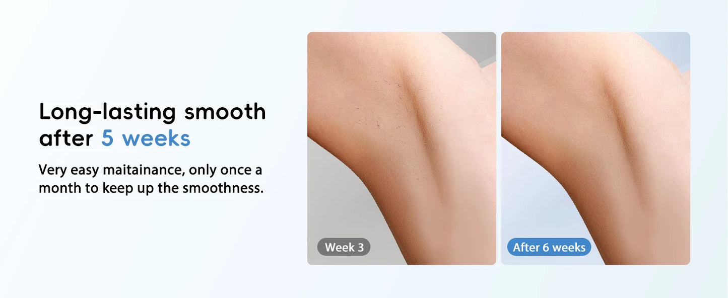 TOTMIZBY ™️Laser Hair Removal Epilator Painless for Women and MEN IPL Hair Removal Home Hair Removal Beauty Device Facial Body Bikini Permanent