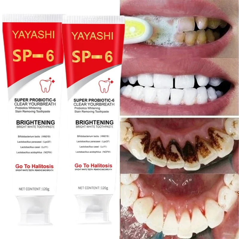 Sweet Tooth Whitener™ Probiotic Toothpaste SP-6 Whitening Tooth Remove Plaque Stains Teeth Whitener Oral Hygiene Clean Fresh Breath Denta 120g New